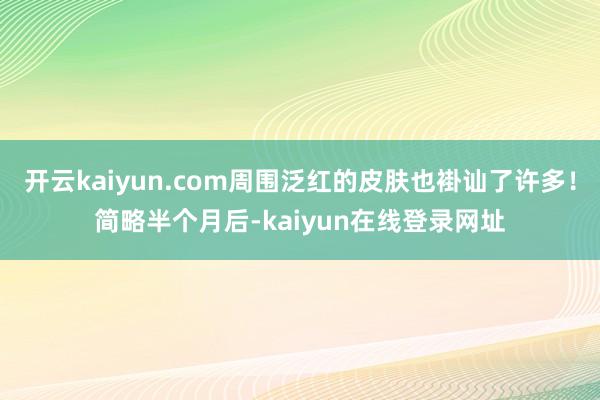 开云kaiyun.com周围泛红的皮肤也褂讪了许多!简略半个月后-kaiyun在线登录网址